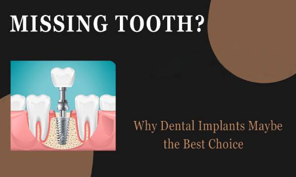 Missing tooth? Why Dental Implants Maybe The Best Choice